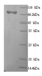 SDS-PAGE (MRC1-1462H).jpg